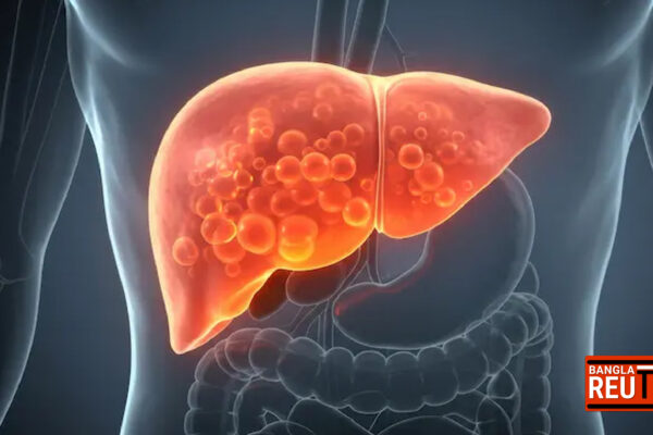 রোগা শরীরেও থাবা বসাচ্ছে ফ্যাটি লিভার: মাসে ঠিক কত লিটার তেল নিরাপদ?